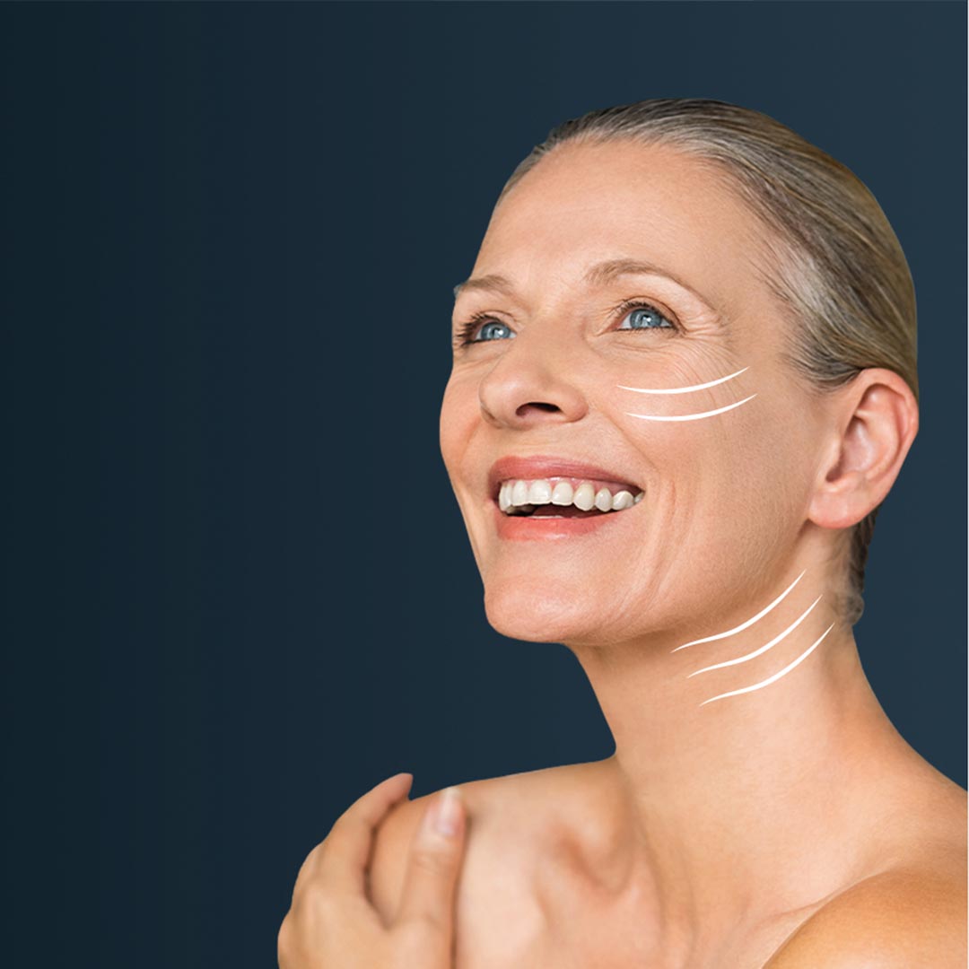 Who is a candidate for skin tightening?